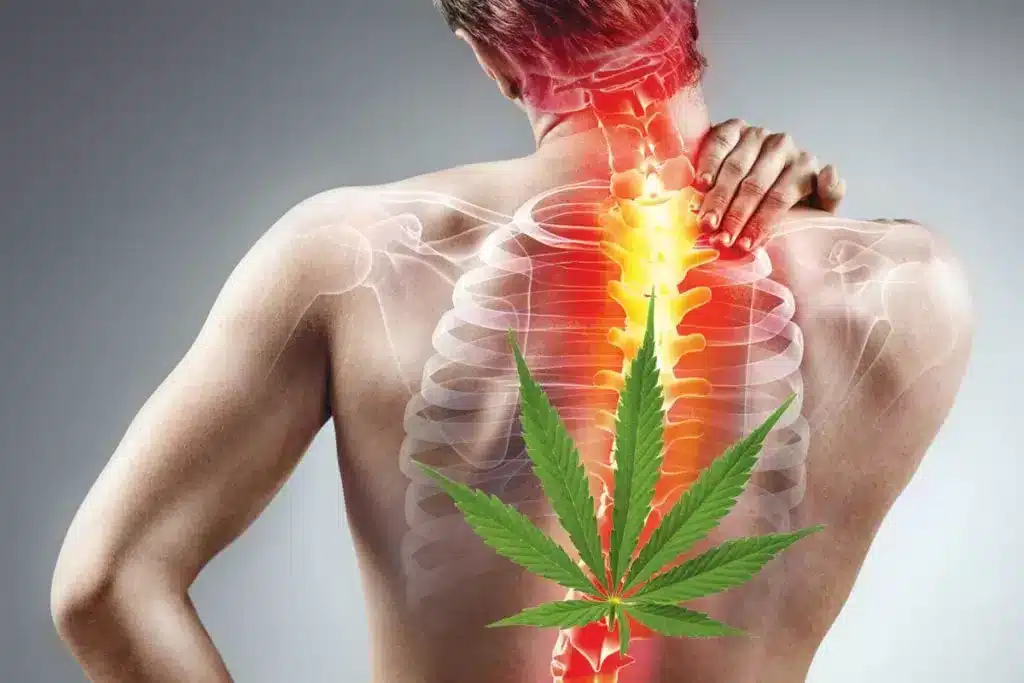 cannabis muscle soreness