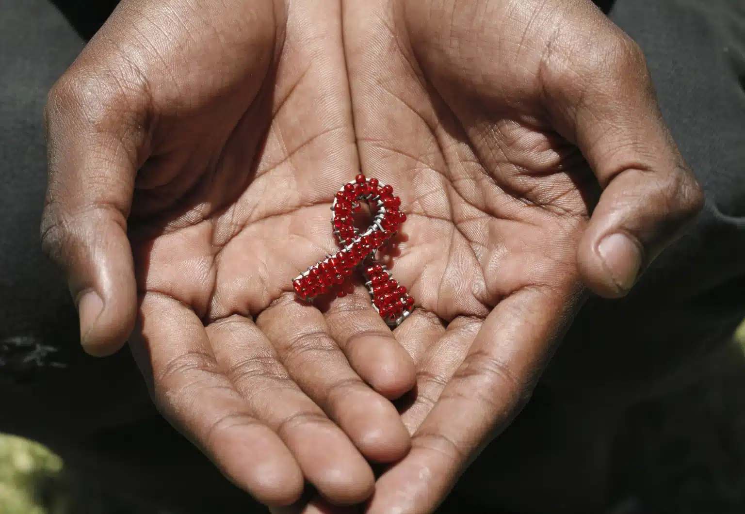 hiv aids treatment